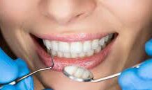 Этапы подготовки к имплантации зубов